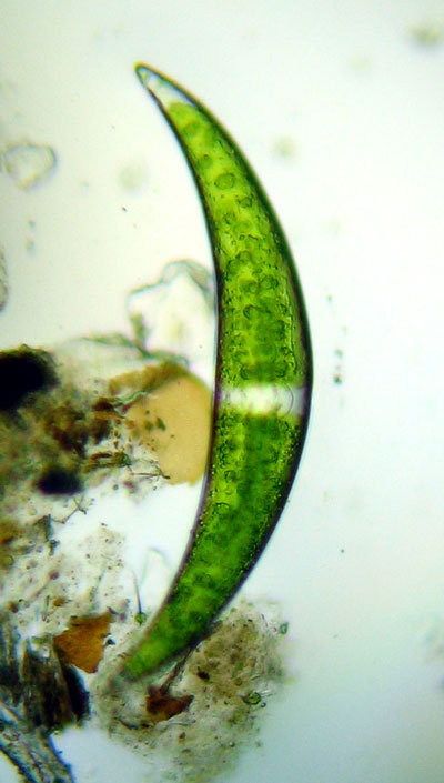Closterium sp
