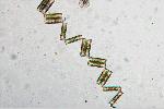 Diatoma sp