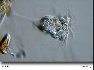 Vorticella sp