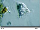 Vorticella sp