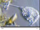 Vorticella sp